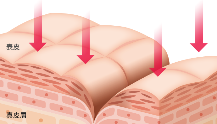 ナイアシンアミドが真皮層までしっかり浸透
